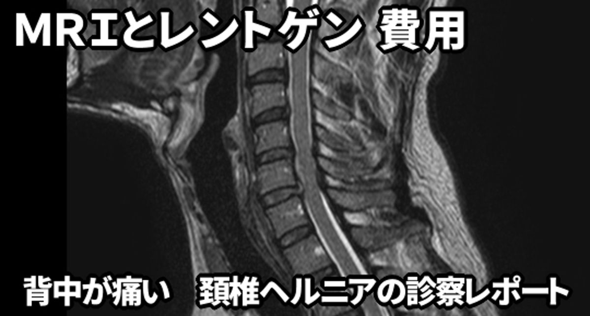 MRIとレントゲン