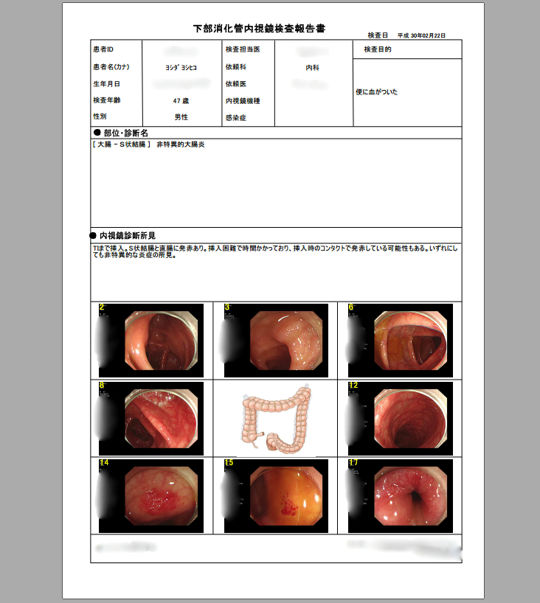 大腸の内視鏡検査の体験談